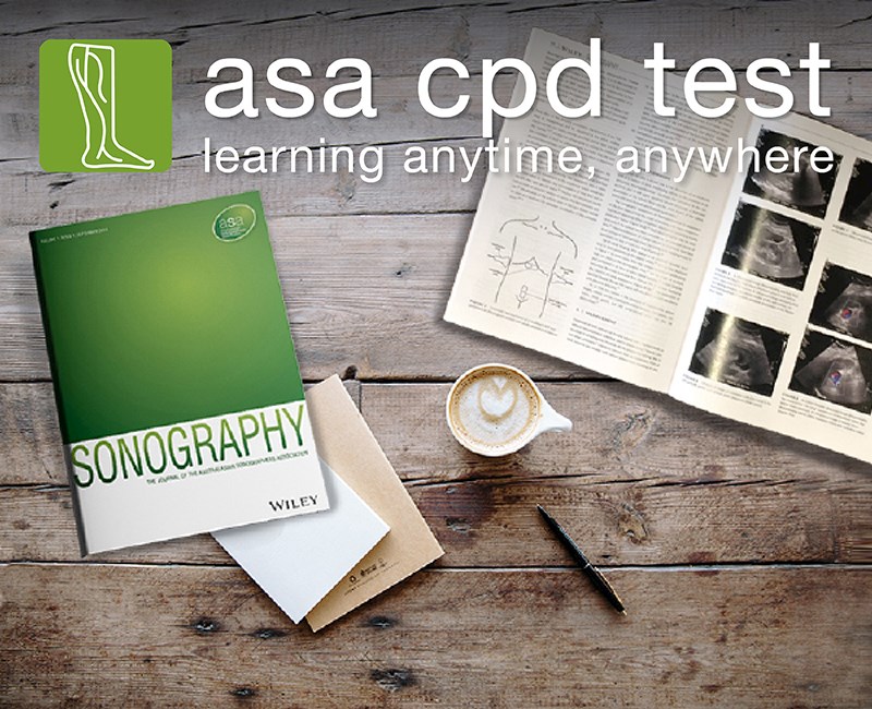 ASA CPD Test - A Rare Case of Postpartum Ovarian Vein Thrombosis