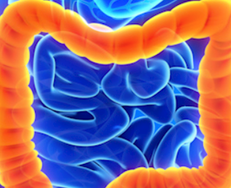 Ultrasound can help guide treatment in ulcerative colitis